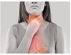 Acid Reflux throat irritation