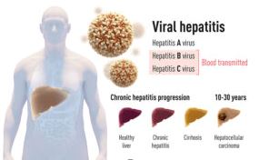 Hepatitis in Lagos